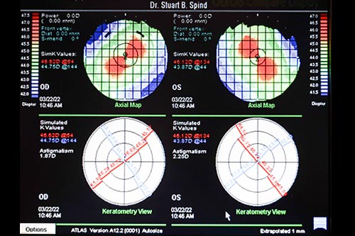 picture of orthokeratology-in-glen-bunie-maryland